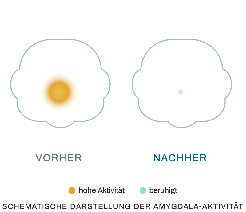 Schematische Darstellung der Amygdala-Aktivität – vorher und nachher