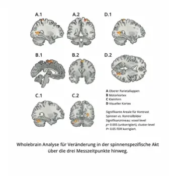 Wholebrain Wholebrain